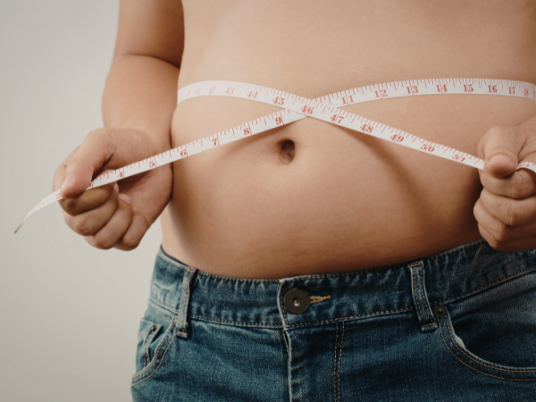 Revision Weight Loss Surgery